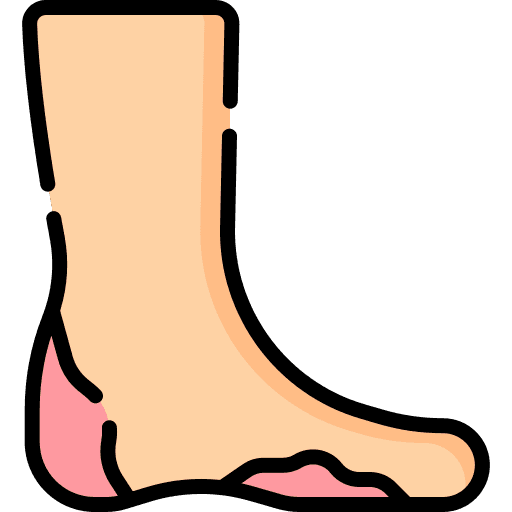 Diabetic foot