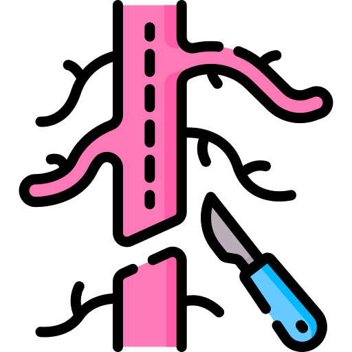 Vascular Surgery